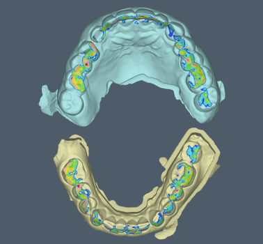 Modjaw™ - Static occlusion is not enough